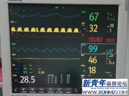 澳门开奖直播,稳定性操作方案分析_旗舰款63.517